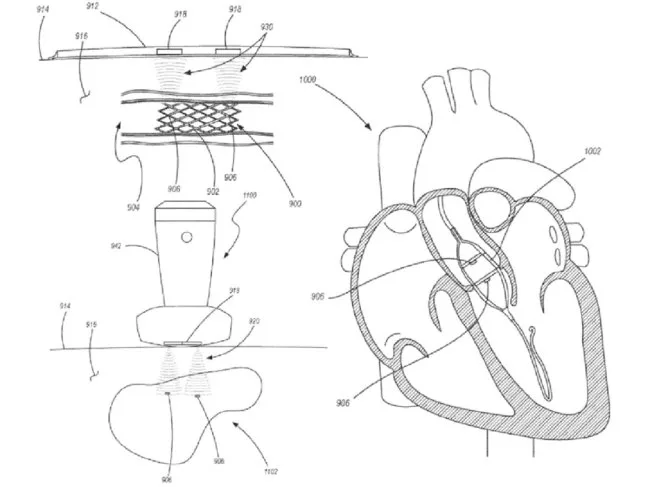xenter ultrasonic sensor